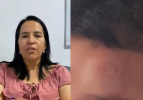 Criança de 7 anos sofre queda em escola de Bom Conselho; Secretária questiona versão da família.